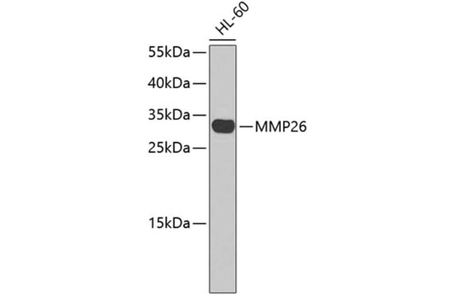 Western Blot - Anti-MMP26 Antibody (A3036) - Antibodies.com