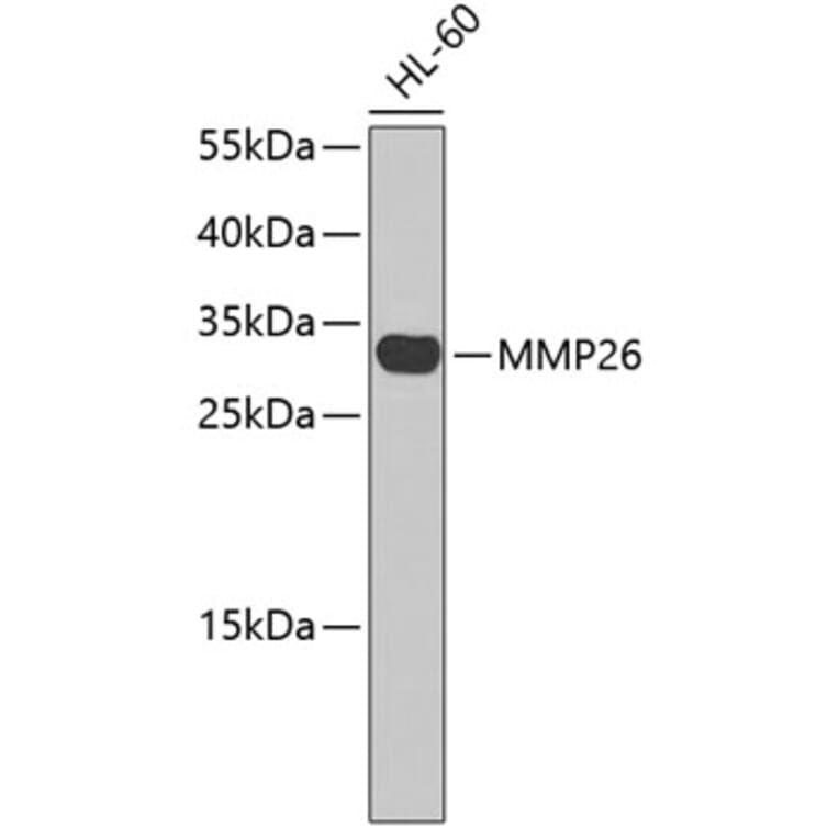 Western Blot - Anti-MMP26 Antibody (A3036) - Antibodies.com