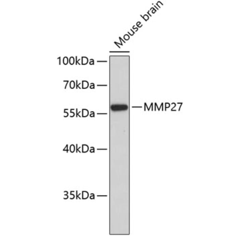 Western Blot - Anti-MMP27 Antibody (A3037) - Antibodies.com