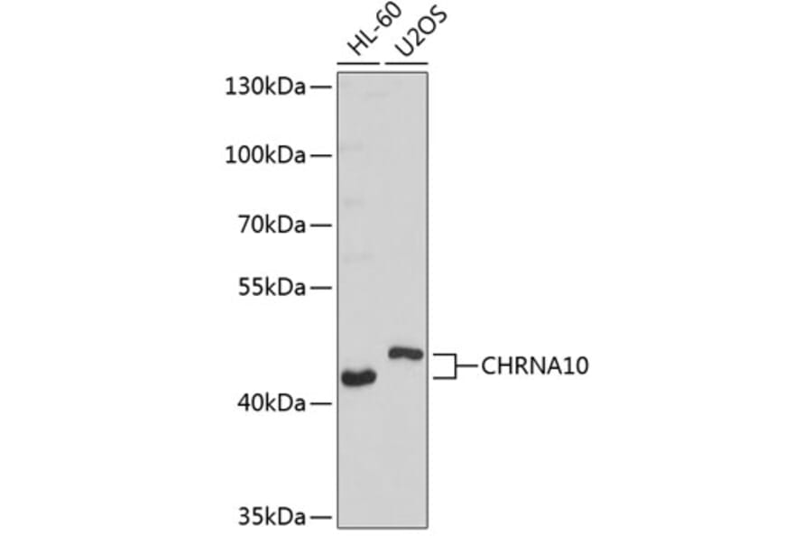 Western Blot - Anti-CHRNA10 Antibody (A9137) - Antibodies.com