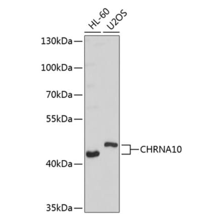 Western Blot - Anti-CHRNA10 Antibody (A9137) - Antibodies.com