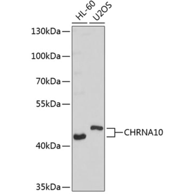Western Blot - Anti-CHRNA10 Antibody (A9137) - Antibodies.com