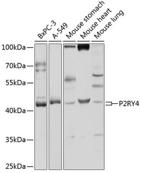 Western blot analysis of extracts of various cell lines, using Anti-P2RY4 Antibody (A3059) at 1:1,000 dilution.
Secondary antibody: Goat Anti-Rabbit IgG (H+L) (HRP) (AS014) at 1:10,000 dilution.
Lysates / proteins: 25µg per lane.
Blocking buffer: 3% non-fat dry milk in TBST.
Detection: ECL Basic Kit (RM00020).
Exposure time: 5s.