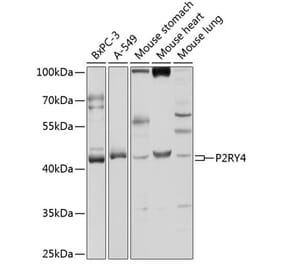 Western Blot - Anti-P2Y4 Antibody (A9140) - Antibodies.com