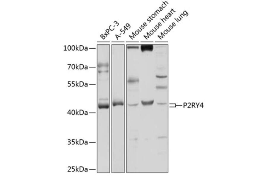 Western Blot - Anti-P2Y4 Antibody (A9140) - Antibodies.com