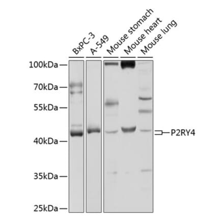 Western Blot - Anti-P2Y4 Antibody (A9140) - Antibodies.com