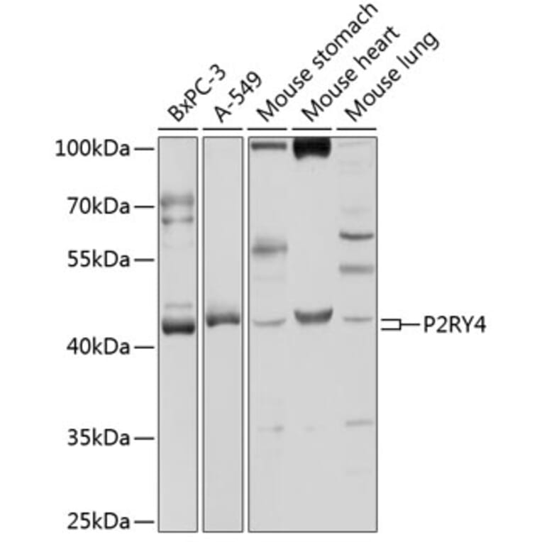 Western Blot - Anti-P2Y4 Antibody (A9140) - Antibodies.com