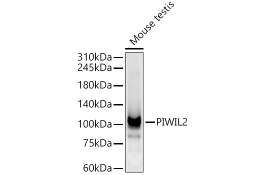 Western Blot - Anti-PIWIL2 Antibody (A9143) - Antibodies.com
