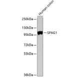 Western Blot - Anti-SPAG1 Antibody (A3087) - Antibodies.com