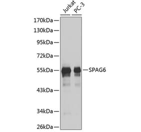 Western Blot - Anti-SPAG6 Antibody (A9146) - Antibodies.com