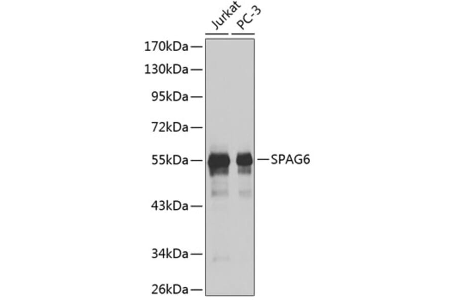 Western Blot - Anti-SPAG6 Antibody (A9146) - Antibodies.com
