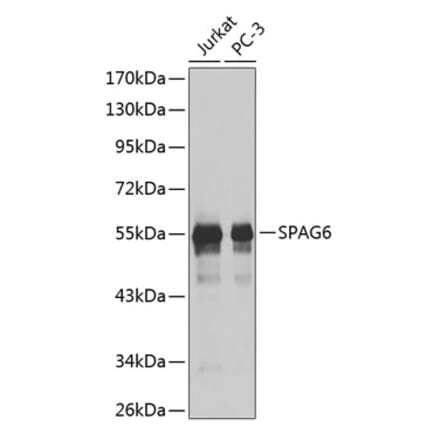 Western Blot - Anti-SPAG6 Antibody (A9146) - Antibodies.com