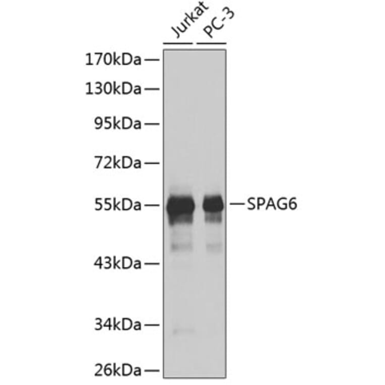 Western Blot - Anti-SPAG6 Antibody (A9146) - Antibodies.com