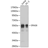 Western Blot - Anti-SPAG6 Antibody (A9146) - Antibodies.com