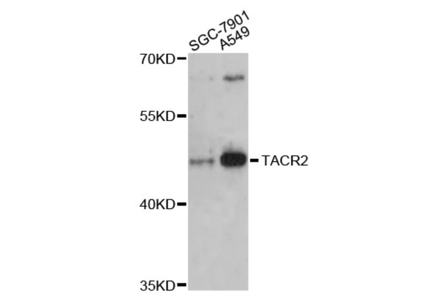 Western Blot - Anti-TACR2 Antibody (A3112) - Antibodies.com