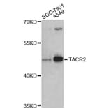 Western Blot - Anti-TACR2 Antibody (A3112) - Antibodies.com