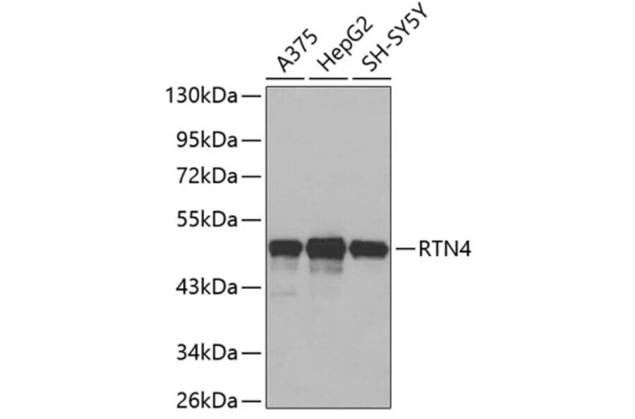 Western Blot - Anti-RTN4 Antibody (A3138) - Antibodies.com