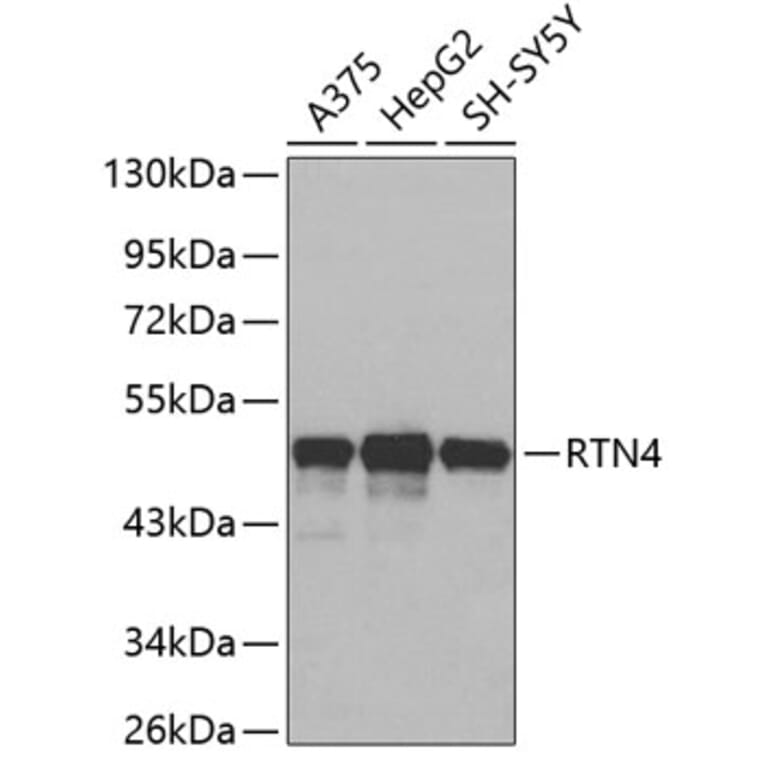 Western Blot - Anti-RTN4 Antibody (A3138) - Antibodies.com