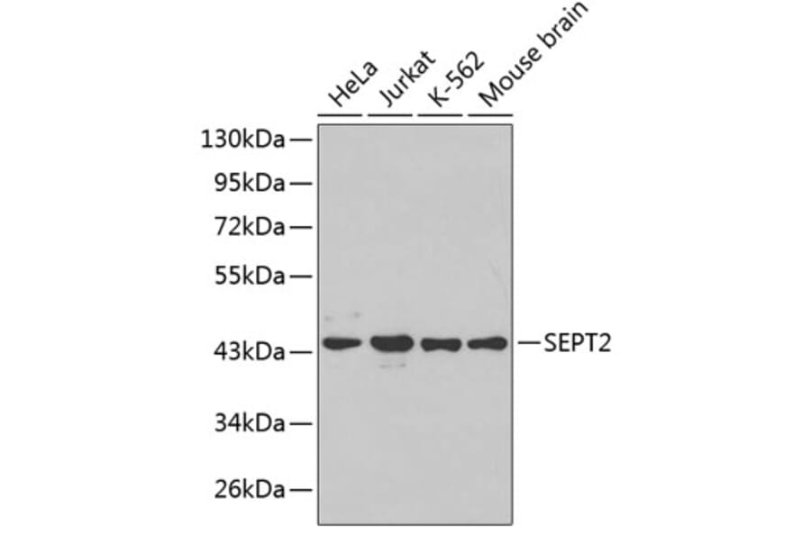 Western Blot - Anti-SEPT2 Antibody (A3147) - Antibodies.com