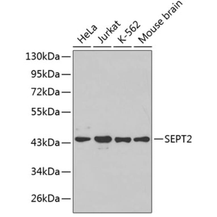Western Blot - Anti-SEPT2 Antibody (A3147) - Antibodies.com