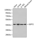 Western Blot - Anti-SEPT2 Antibody (A3147) - Antibodies.com