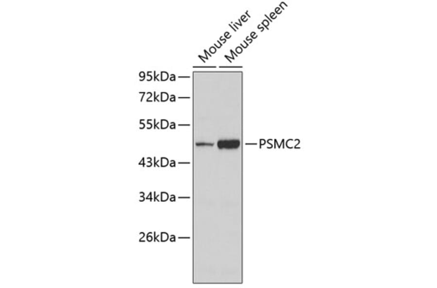 Western Blot - Anti-PSMC2 Antibody (A3195) - Antibodies.com
