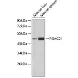 Western Blot - Anti-PSMC2 Antibody (A3195) - Antibodies.com