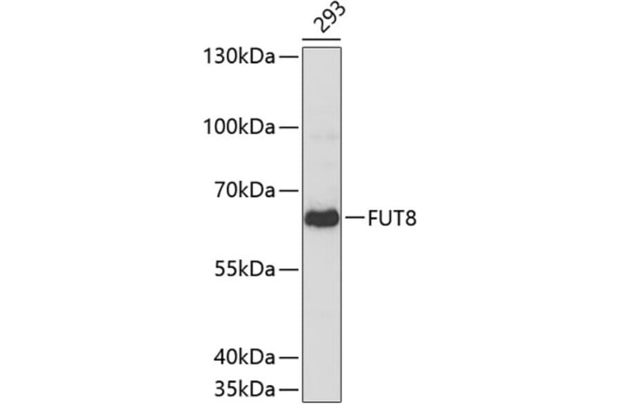 Western Blot - Anti-FUT8 Antibody (A3201) - Antibodies.com