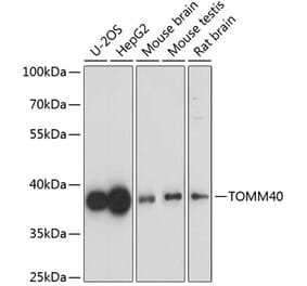 Western Blot - Anti-TOMM40 Antibody (A9160) - Antibodies.com