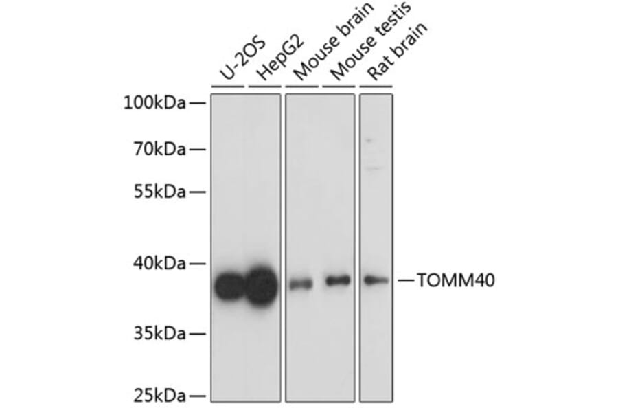 Western Blot - Anti-TOMM40 Antibody (A9160) - Antibodies.com