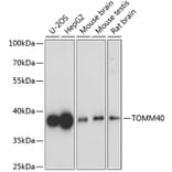 Western Blot - Anti-TOMM40 Antibody (A9160) - Antibodies.com