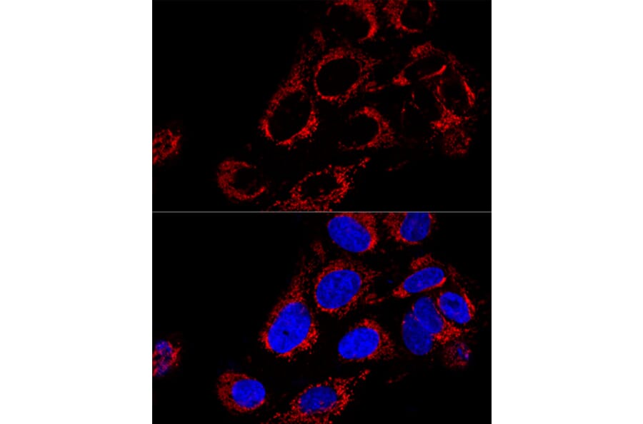 Immunofluorescence - Anti-TOMM40 Antibody (A9160) - Antibodies.com