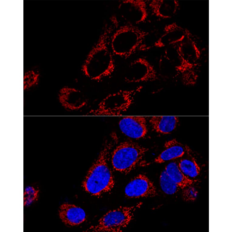 Immunofluorescence - Anti-TOMM40 Antibody (A9160) - Antibodies.com