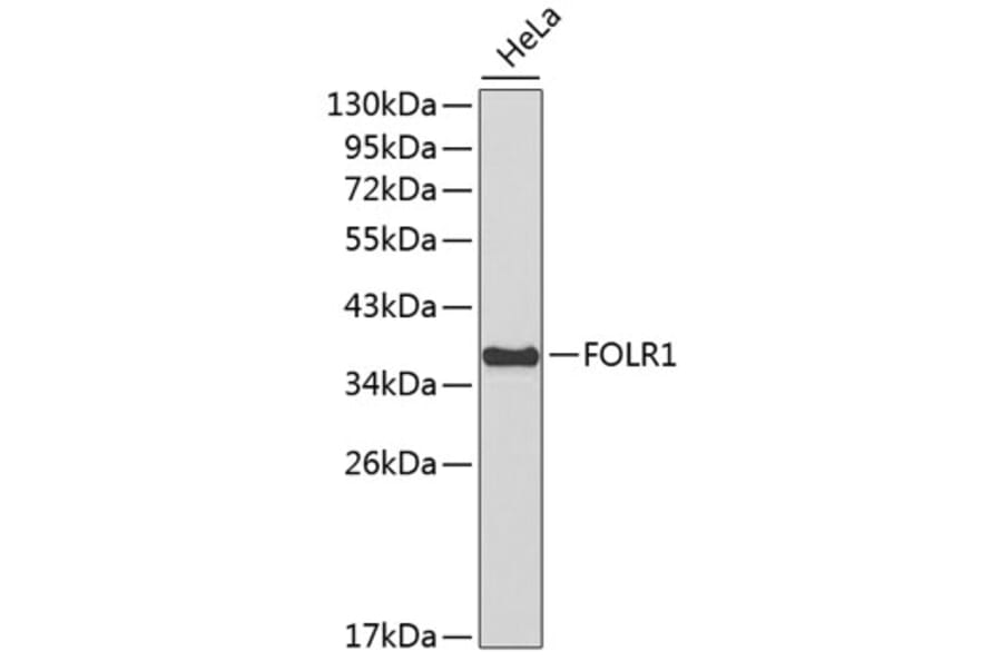 Western Blot - Anti-FOLR1 Antibody (A3215) - Antibodies.com