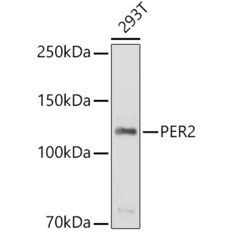Western Blot - Anti-PER2 Antibody (A9162) - Antibodies.com