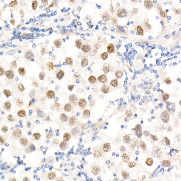 Immunohistochemistry - Anti-Nanog Antibody (A9165) - Antibodies.com