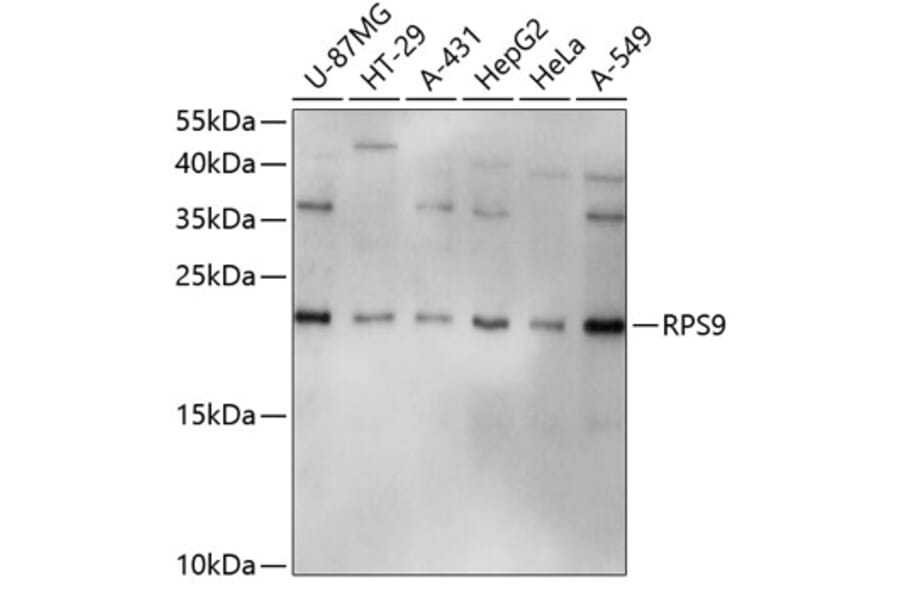 Western Blot - Anti-RPS9 Antibody (A3242) - Antibodies.com