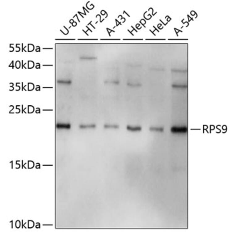 Western Blot - Anti-RPS9 Antibody (A3242) - Antibodies.com