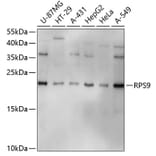 Western Blot - Anti-RPS9 Antibody (A3242) - Antibodies.com