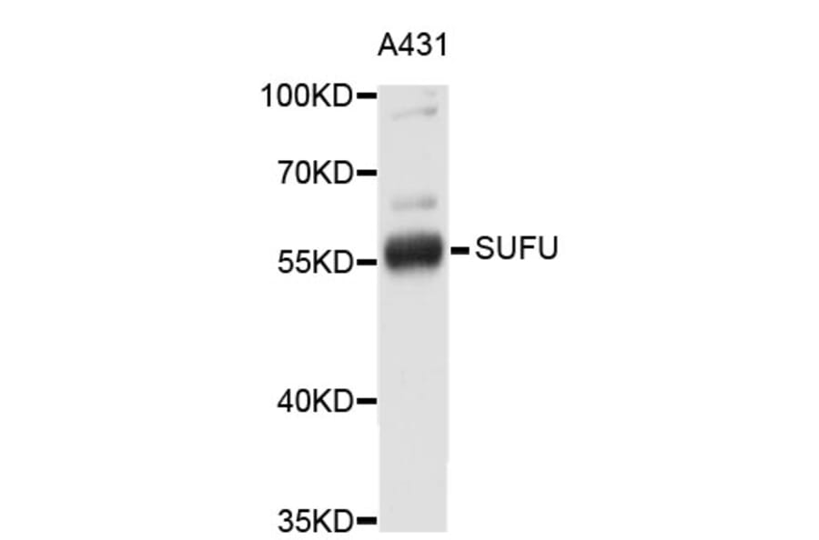 Western Blot - Anti-SUFU Antibody (A3273) - Antibodies.com