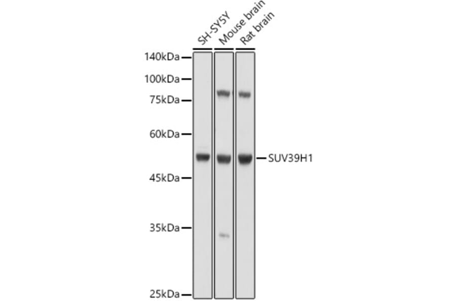 Western Blot - Anti-KMT1A/SUV39H1 Antibody (A9172) - Antibodies.com