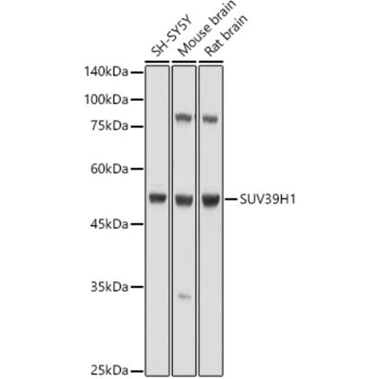 Western Blot - Anti-KMT1A/SUV39H1 Antibody (A9172) - Antibodies.com