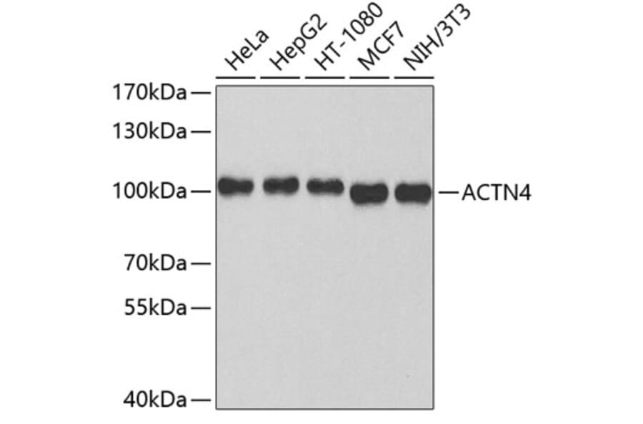 Western Blot - Anti-ACTN4 Antibody (A3284) - Antibodies.com
