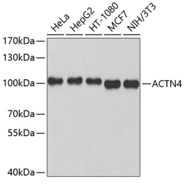 Western Blot - Anti-ACTN4 Antibody (A3284) - Antibodies.com