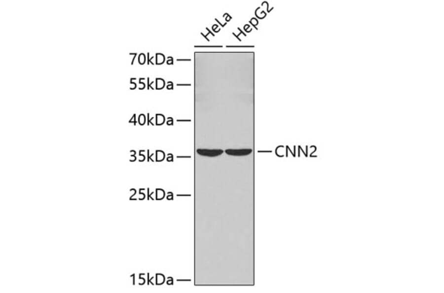 Western Blot - Anti-CNN2 Antibody (A3289) - Antibodies.com
