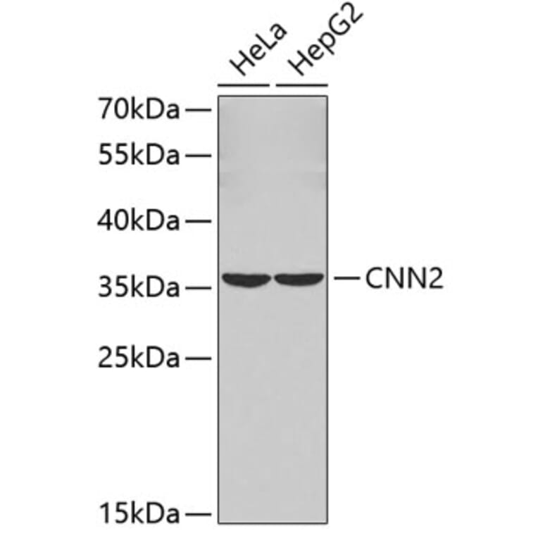 Western Blot - Anti-CNN2 Antibody (A3289) - Antibodies.com