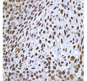 Immunohistochemistry - Anti-Histone H1.2 Antibody (A9176) - Antibodies.com