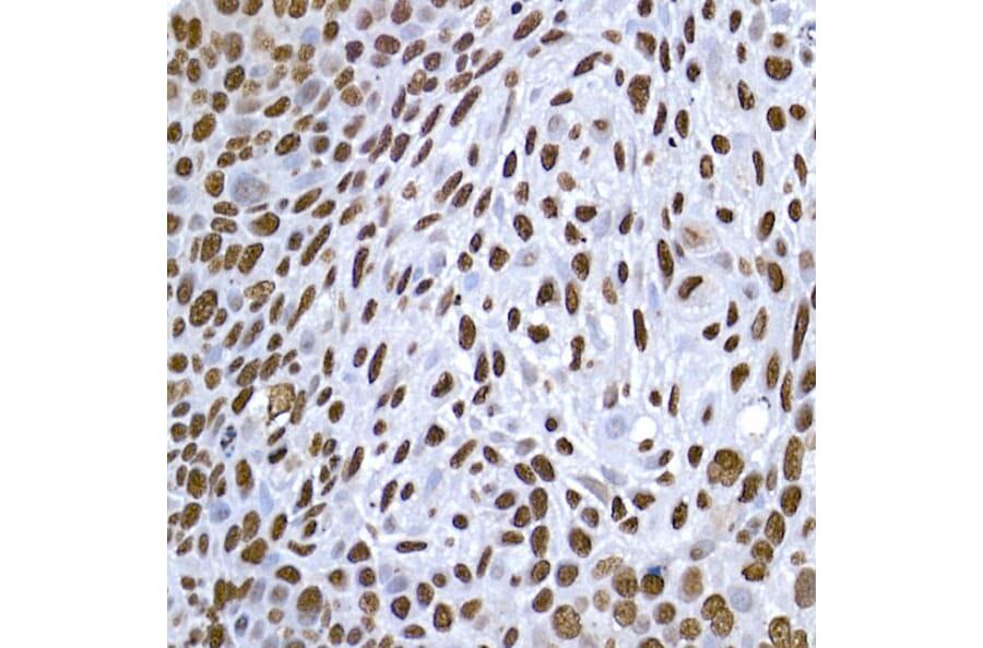 Immunohistochemistry - Anti-Histone H1.2 Antibody (A9176) - Antibodies.com