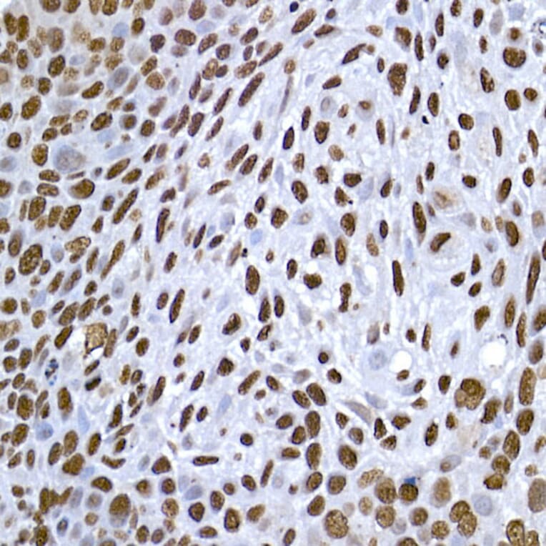 Immunohistochemistry - Anti-Histone H1.2 Antibody (A9176) - Antibodies.com