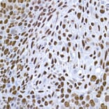 Immunohistochemistry - Anti-Histone H1.2 Antibody (A9176) - Antibodies.com